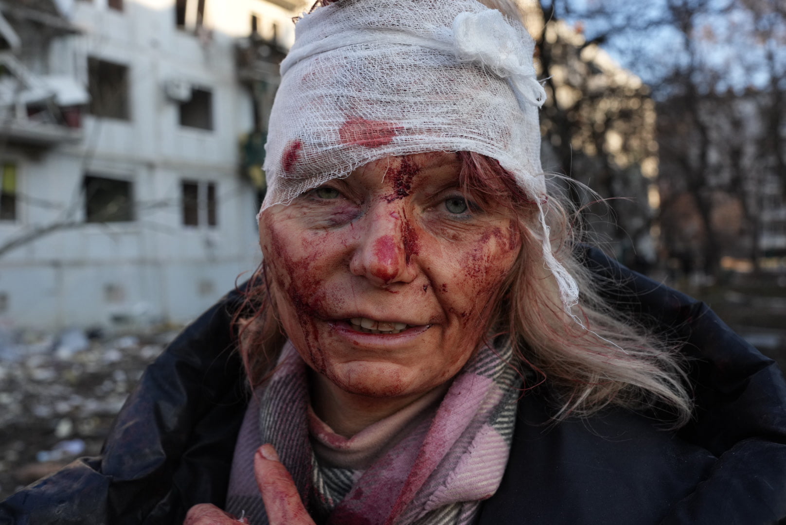 τραυματισμένη γυναίκα στο Χάρκοβο / Wolfgang Schwan / Anadolu Agency / Getty Images, cnn.com